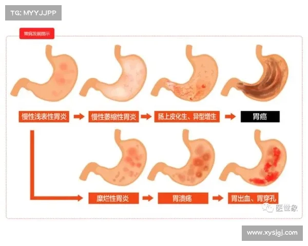 35岁男子忽视幽门螺杆菌感染致胃癌晚期 谁更易感染此病 35岁男子忽视幽门螺杆菌感染致胃癌晚期 谁更易感染此病